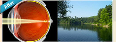 Cataratas Page description After image