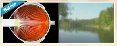 Cataratas Page description Before image