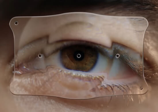 during-the-procedure